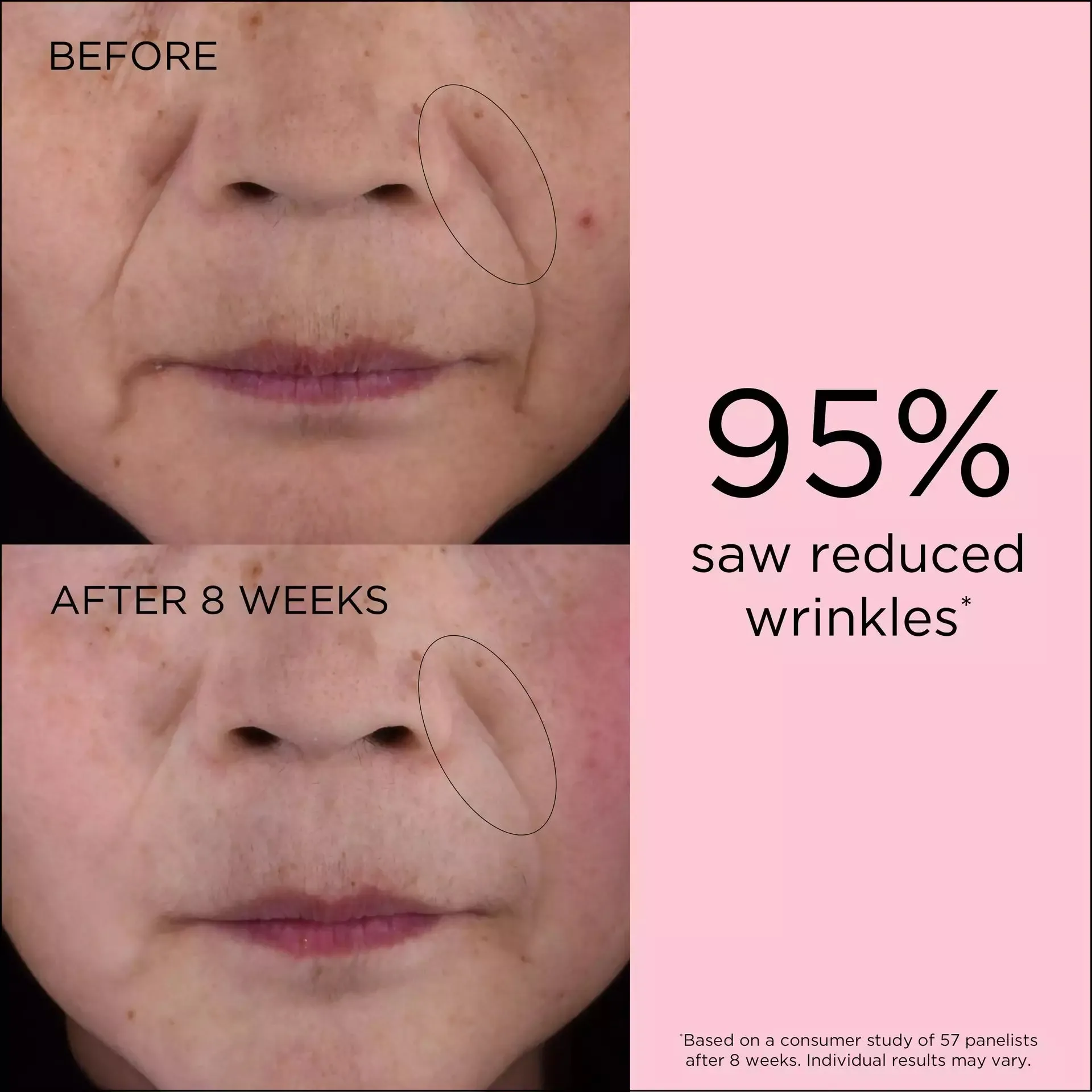 Retinol   HPR Ceramide Capsules Rapid Skin Renewing Serum Set 120 Pieces